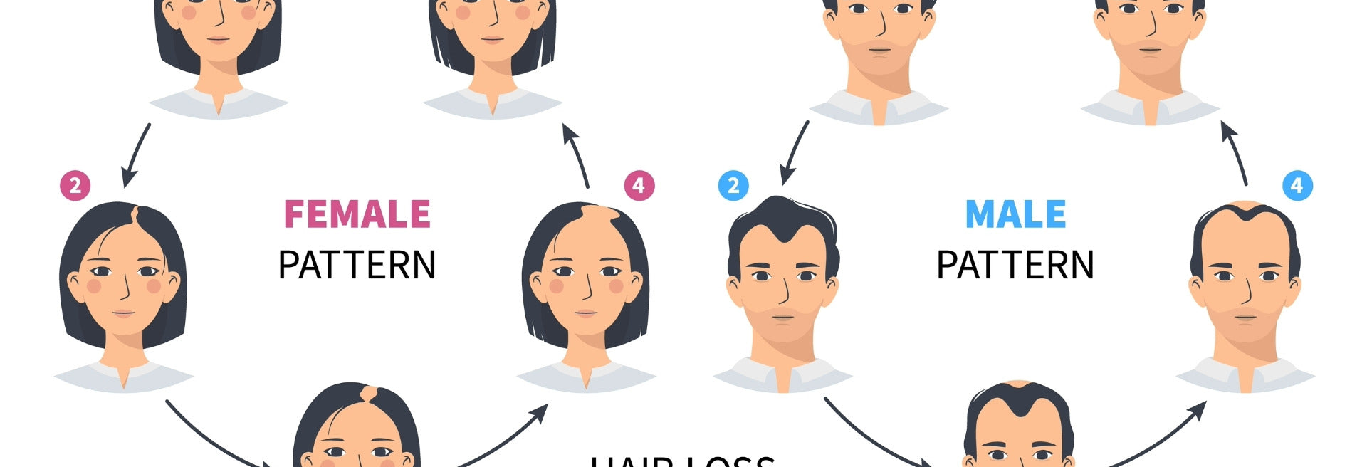 Hair Loss